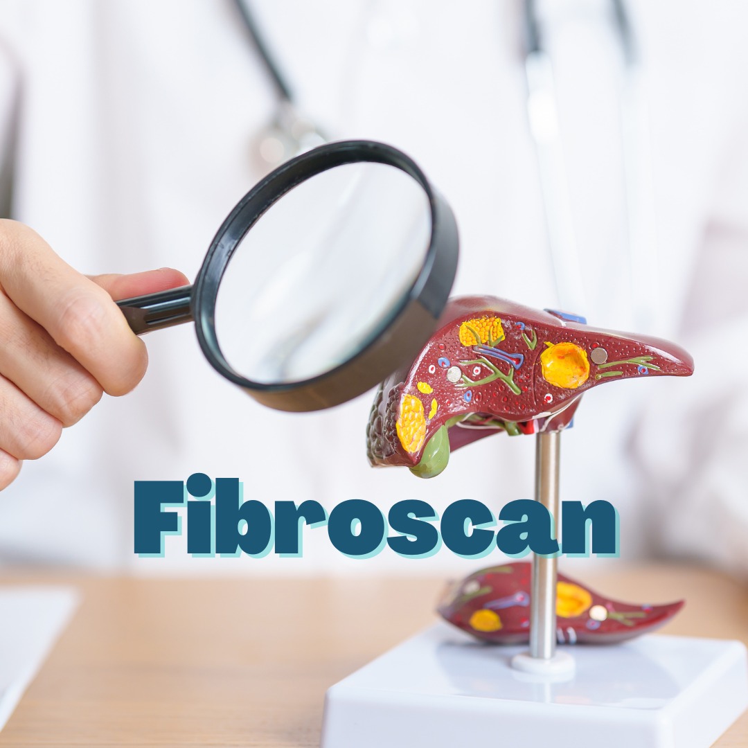 Fibroscan